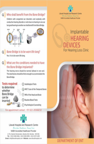 Cochlear Implant